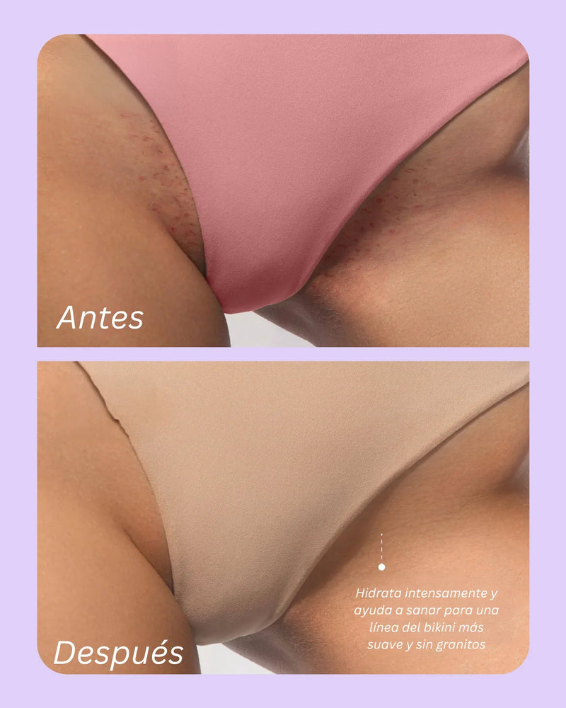 🌸Toque Sexy, Piel Increíble!🌸Aceite Íntimo 100% Natural – Suavidad, Hidratación y Prevención de Irritaciones + ENVÍO GRATIS